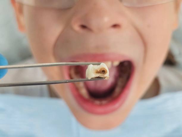 Best Weekend Emergency Dentist in Muskegon Heights, MI
